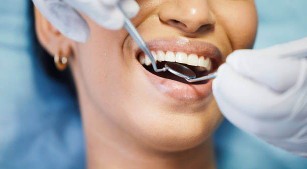 Best Mobile Emergency Dentist in San Anselmo, CA